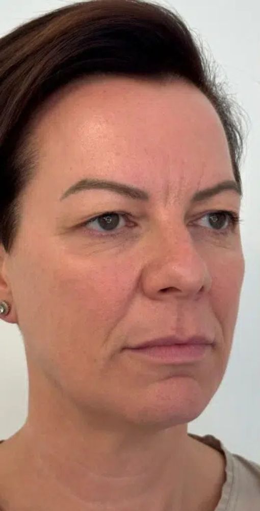 before gallery 1 before gallery 1