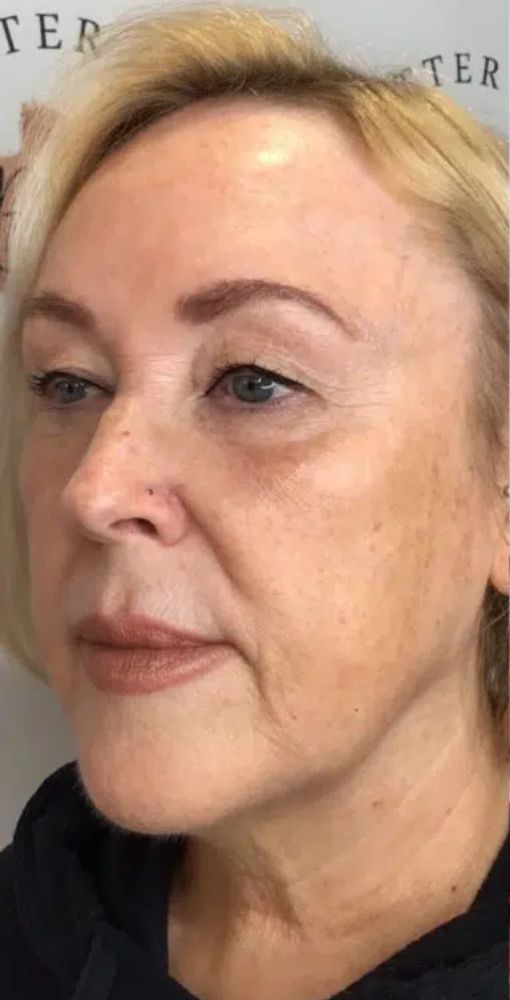 before gallery 2 before gallery 2