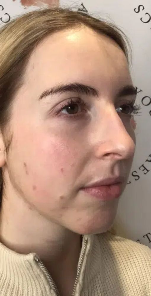 before gallery 3 before gallery 3