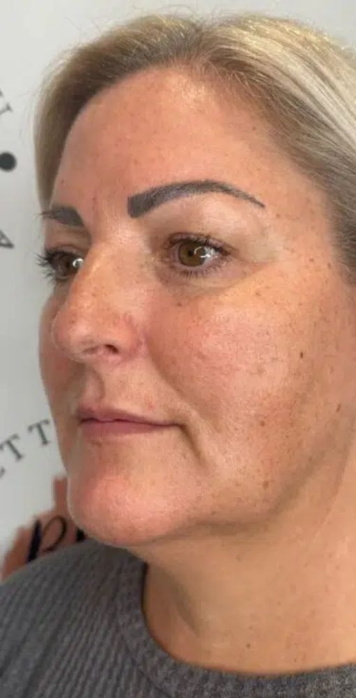 before gallery 4 before gallery 4