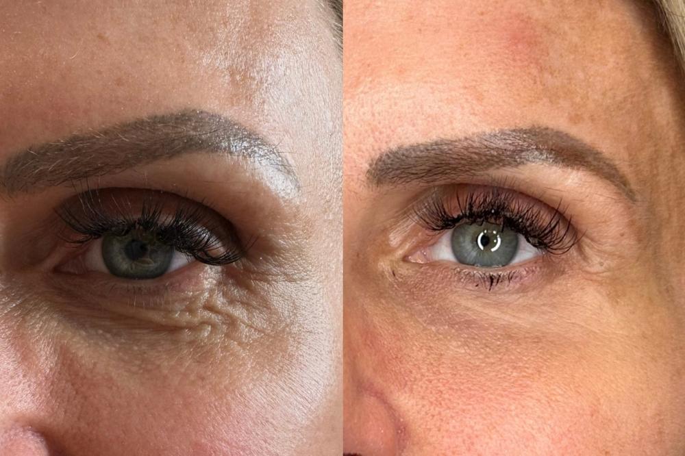 Polynucleotides Results